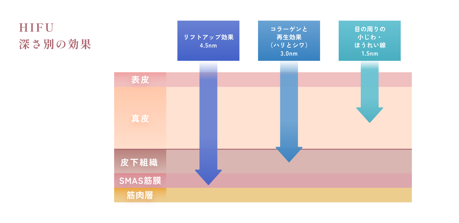 HIFU深さ別の効果