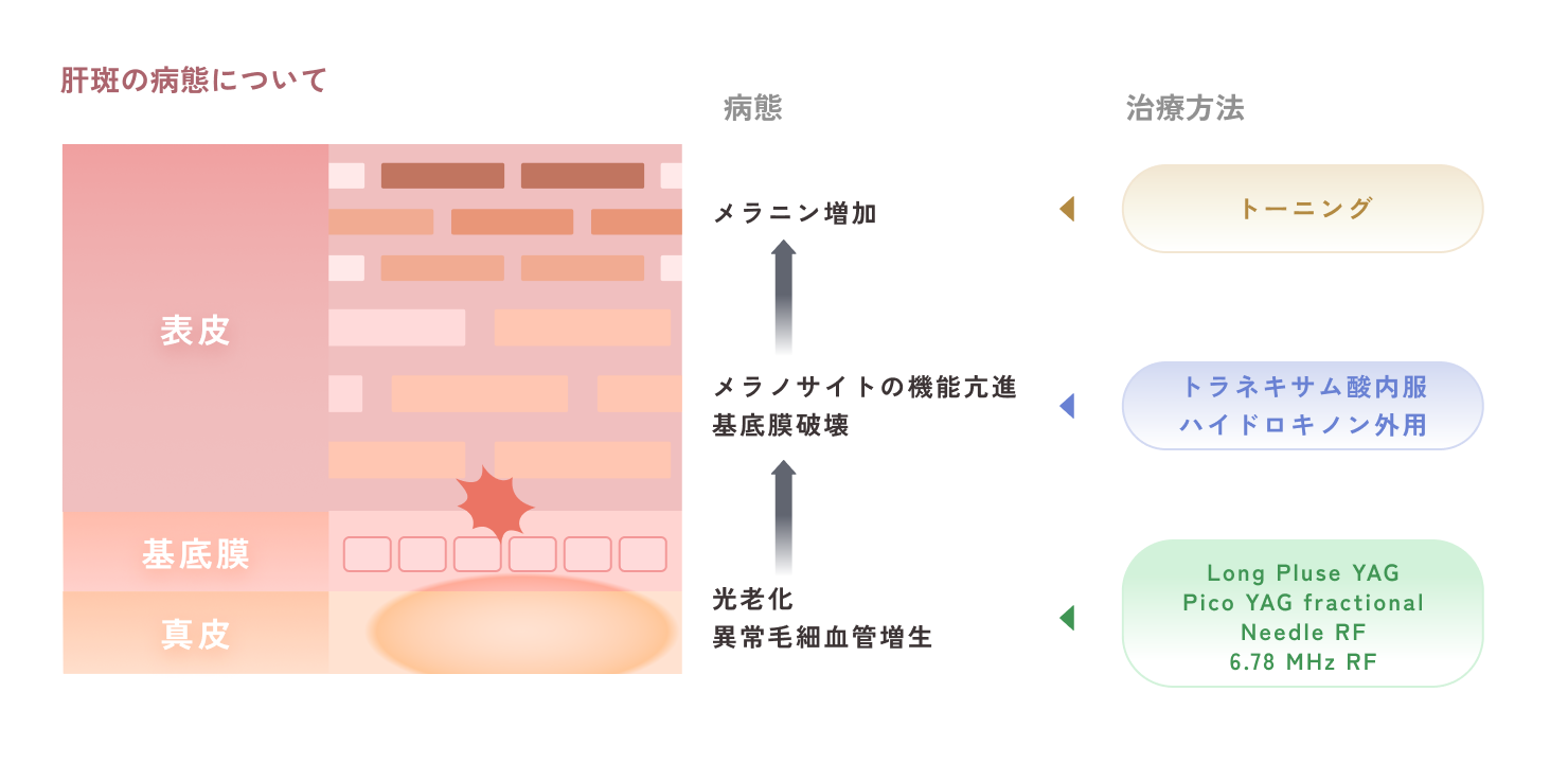 ピコトーニングについて