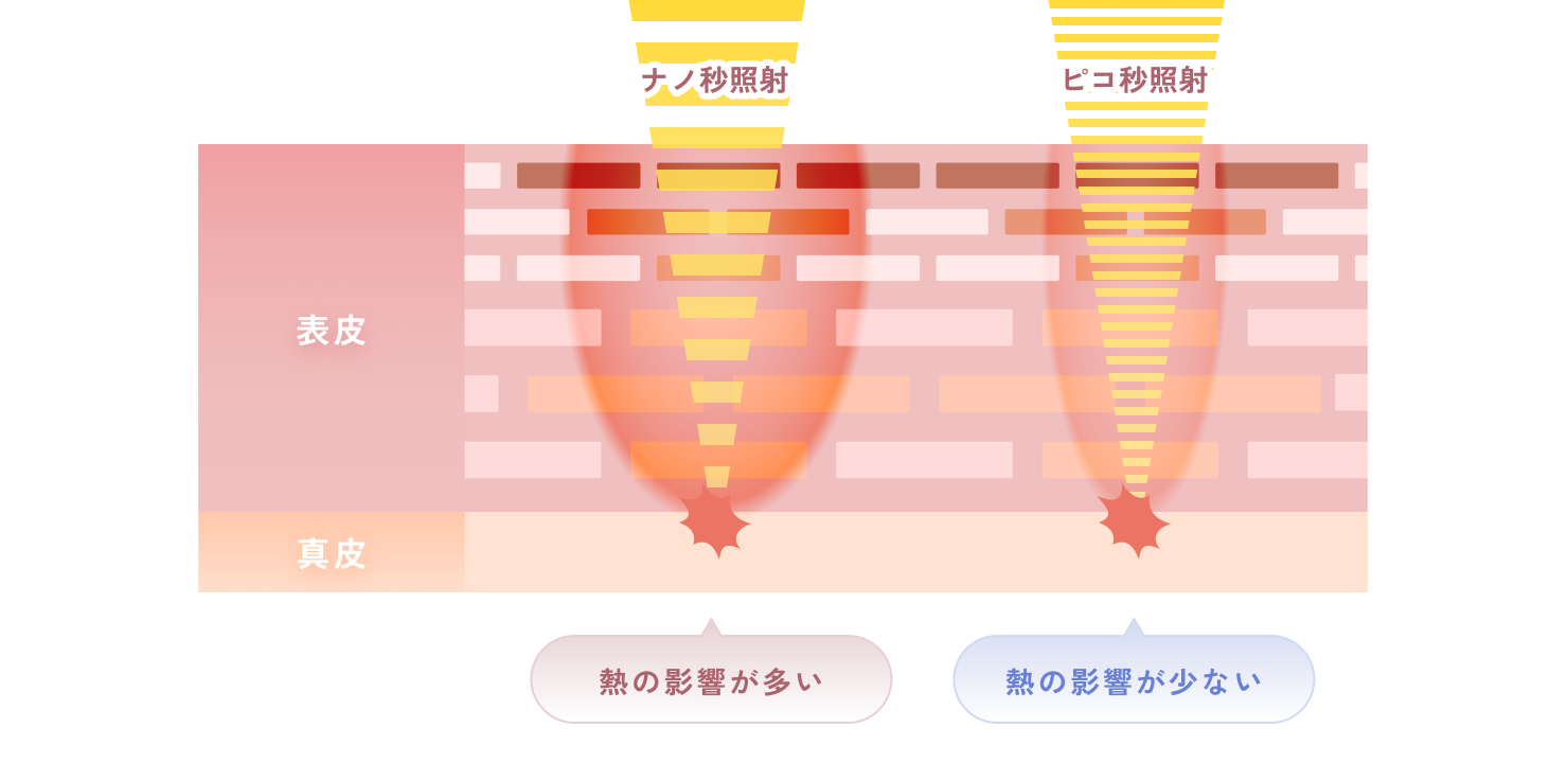 ピコスポットについて