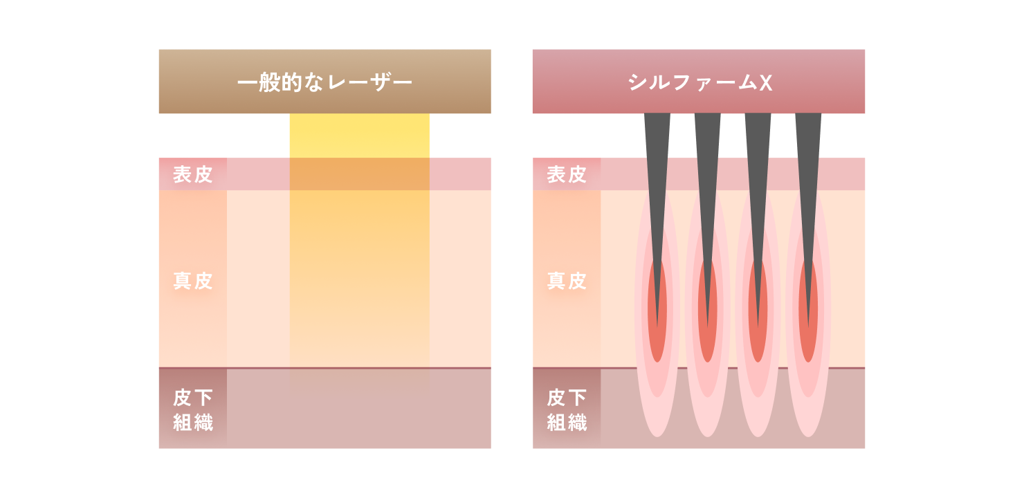シルファームXについて