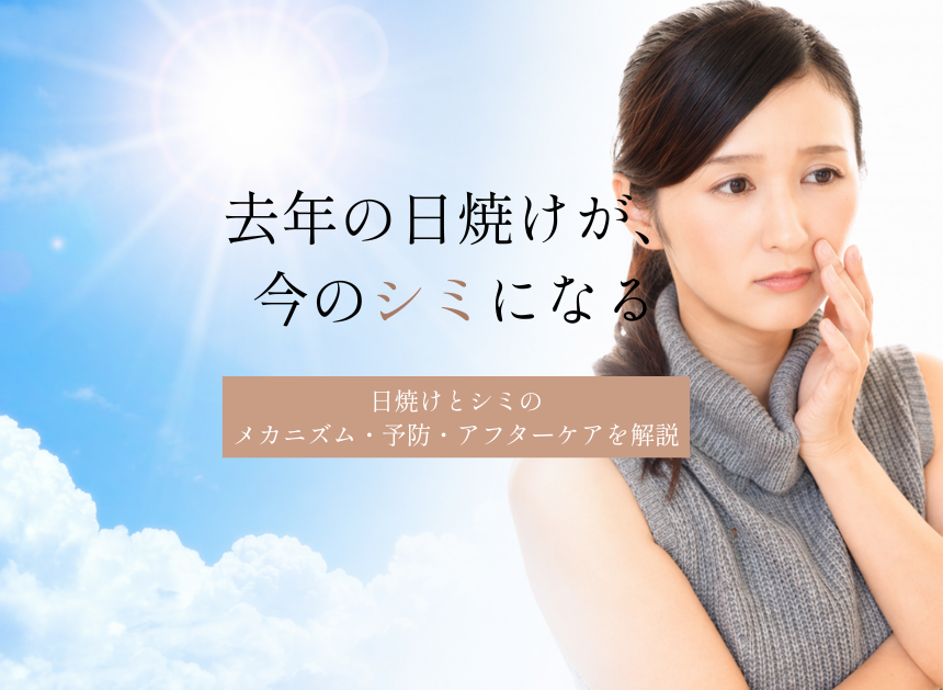 去年の日焼けが、今のシミになる日焼けとシミのメカニズム・予防・アフターケア