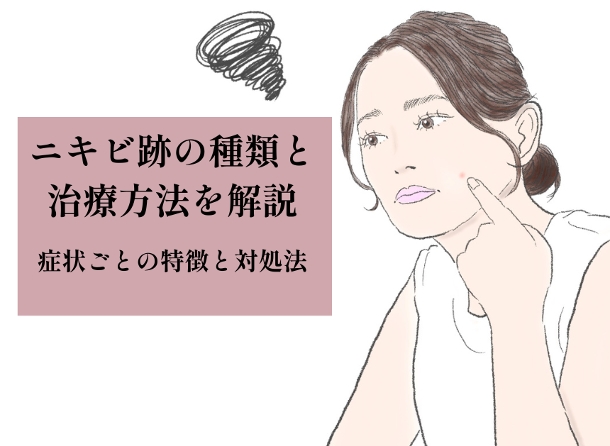 ニキビ跡の種類と治療方法を解説｜症状ごとの特徴と対処法