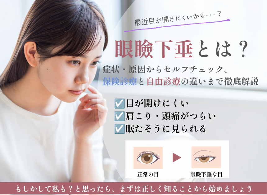 眼瞼下垂とは？症状・原因からセルフチェック、保険診療と自由診療の違いまで徹底解説
